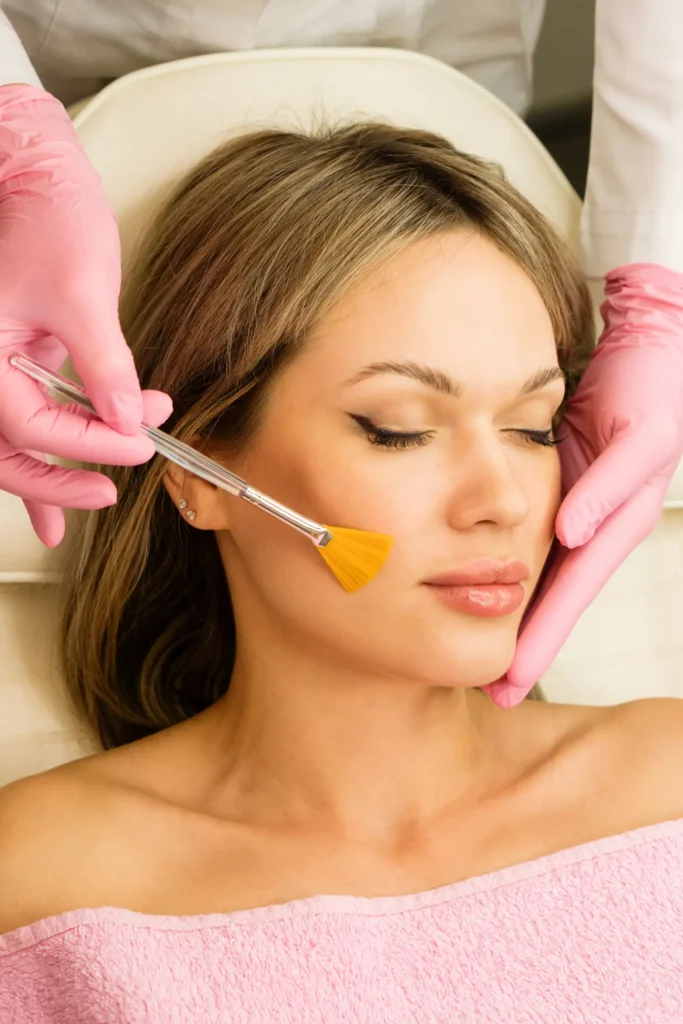 Pigmentation & Melasma, pigmentation in harrow