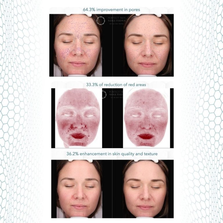 GF5 Next Generation® - Image 4