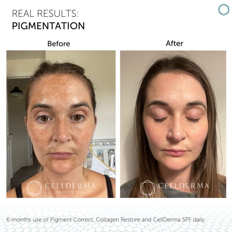 Pigment Correct (Inquire Now) - Image 4