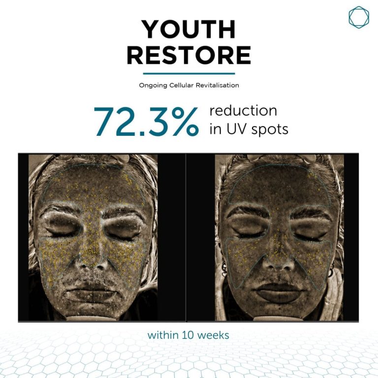 Youth Restore (Inquire Now) - Image 5