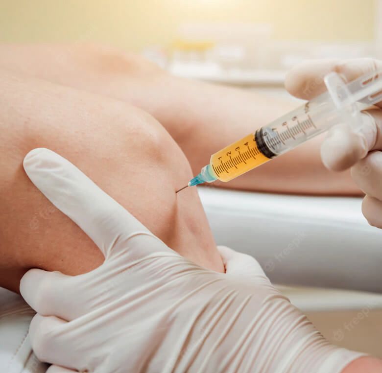 PRP injections for knee