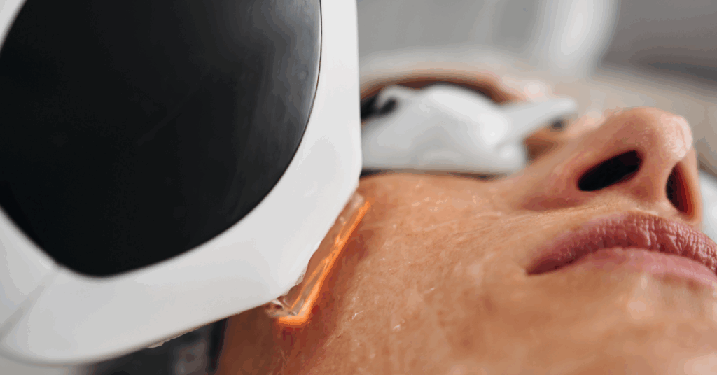 Co2 Laser Treatment in Southall
